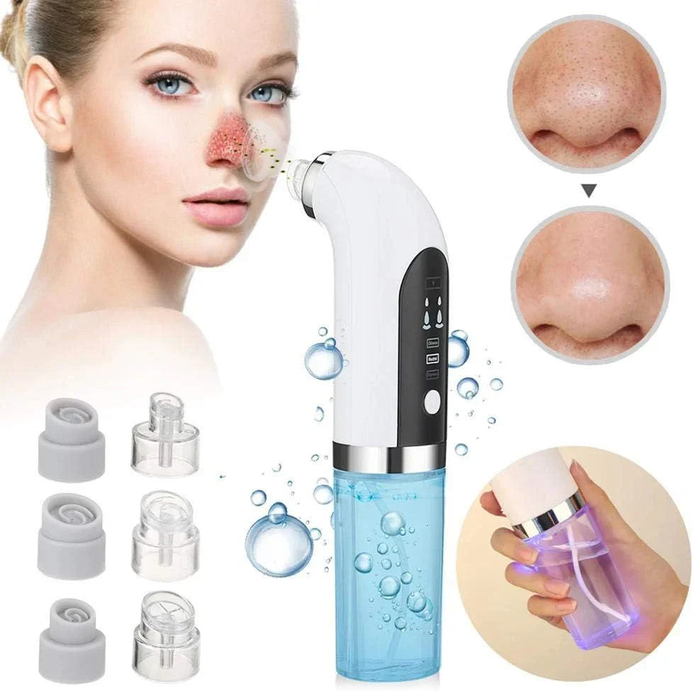 Upgraded Blackhead Remover Pore Vacuum