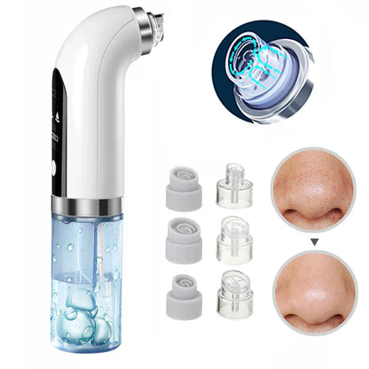 Upgraded Blackhead Remover Pore Vacuum